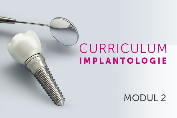 Grundlagen der dentalen Implantologie
