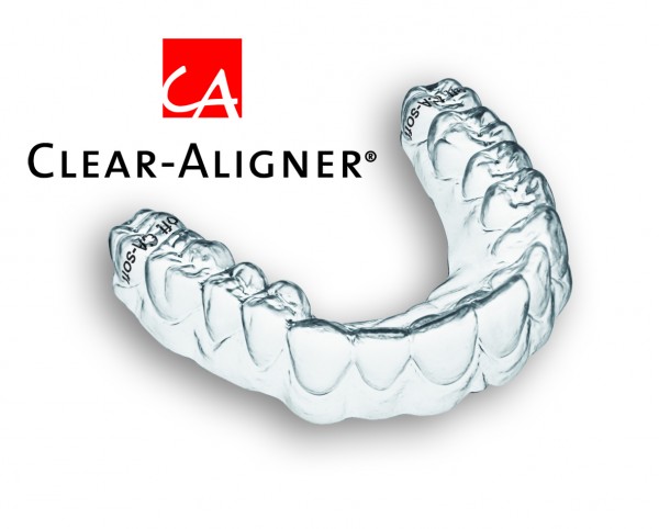 Clear-Aligner Zertifizierungskurs